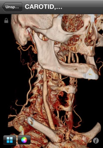 Image 0 for Centricity Radiology Mobi…