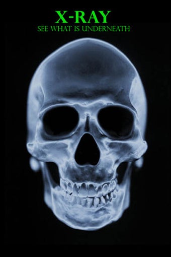 Image 0 for X-ray Scanner