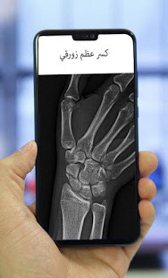 Imagen 1 para xray