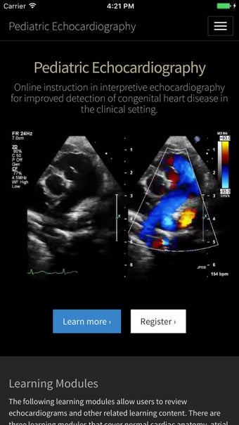 Image 1 for Pediatric Echocardiograph…