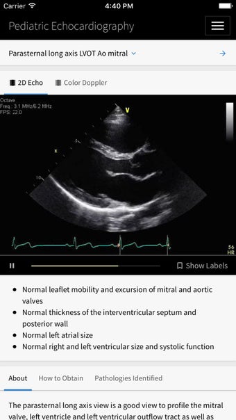Image 0 for Pediatric Echocardiograph…
