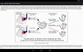 Imagen 2 para EchoSource