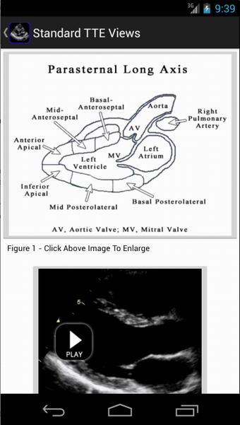Imagen 6 para EchoSource