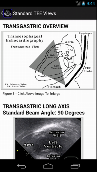 Imagen 0 para EchoSource