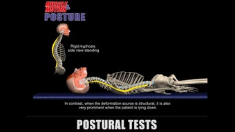 Image 0 for Muscle and Motion POSTURE