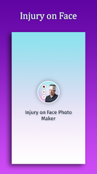 Image 3 for Injury on Face Photo Make…