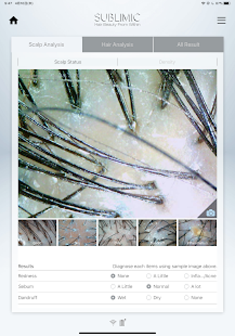 Image 1 for SUBLIMIC Hair & Scalp Che…