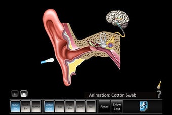 Imagen 0 para Ear Disorders: Outer Midd…