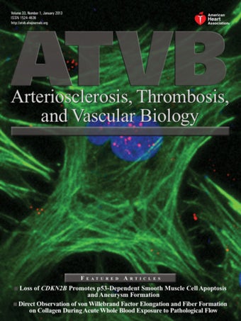 Imagen 0 para Arteriosclerosis, Thrombo…