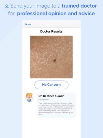 Image 0 for scanoma - mole check