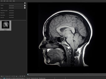 Image 0 for SeePlus DICOM