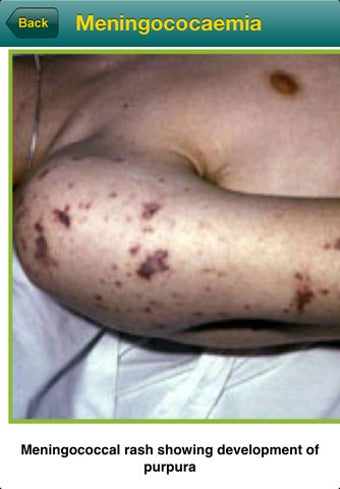 Imagen 0 para Your Rapid Diagnosis - Ch…