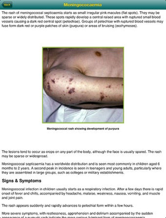 Imagen 6 para Your Rapid Diagnosis - Ch…