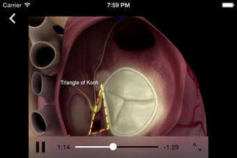 Imagen 0 para HEART MASTER Mitral & Tri…