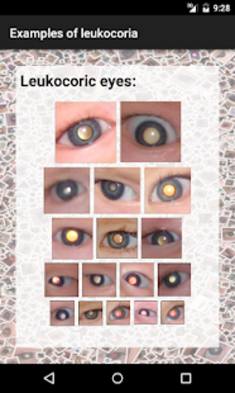 Imagen 1 para CRADLE White Eye Detector
