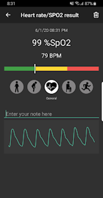 Image 1 for Pulse Oximeter - Beat & O…