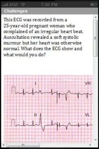 Image 3 for ECG Challenge