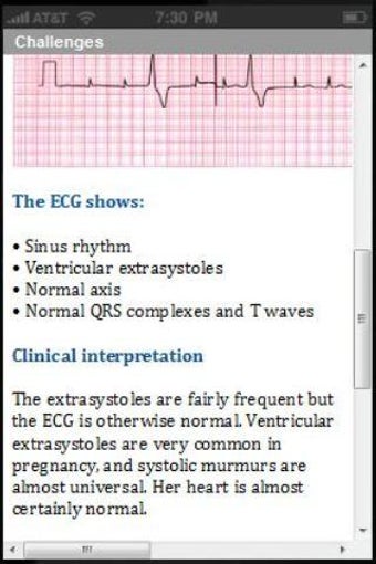 Image 1 for ECG Challenge