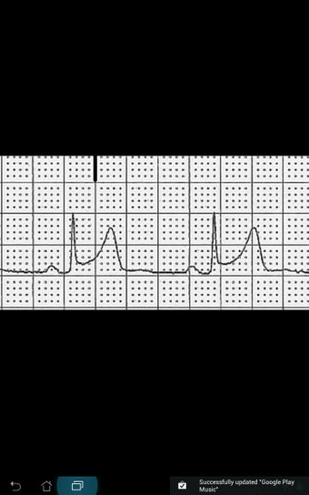 Image 5 for ECG Challenge