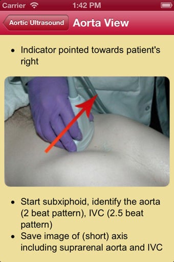 Imagen 1 para POC Ultrasound Guide