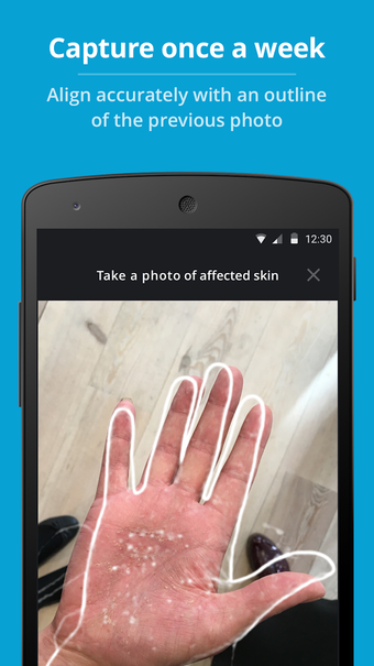 Imagen 1 para Imagine - Skin Condition …