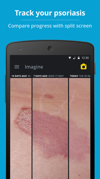 Imagen 2 para Imagine - Skin Condition …