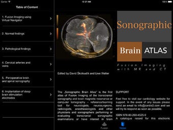 Image 0 for Sonographic Brain Atlas