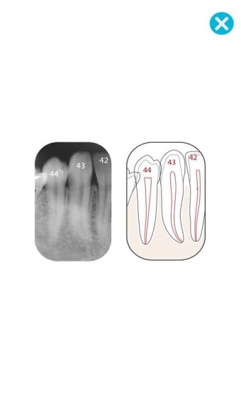 Image 3 for Dental Corpus ANATOMY lit…