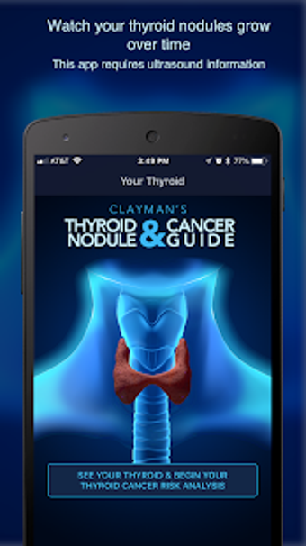 Image 3 for Thyroid Nodule and Cancer…
