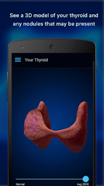 Image 1 for Thyroid Nodule and Cancer…