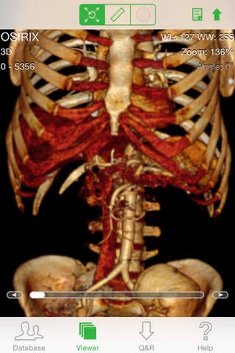 Image 0 for OsiriX HD