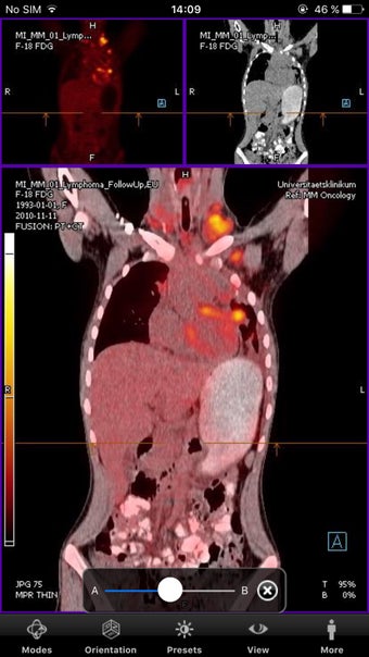 Imagen 0 para syngo.via WebViewer
