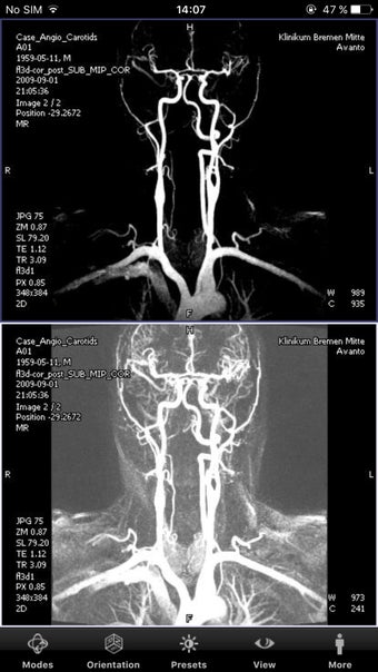 Imagen 2 para syngo.via WebViewer