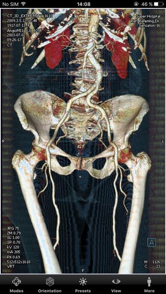 Imagen 1 para syngo.via WebViewer