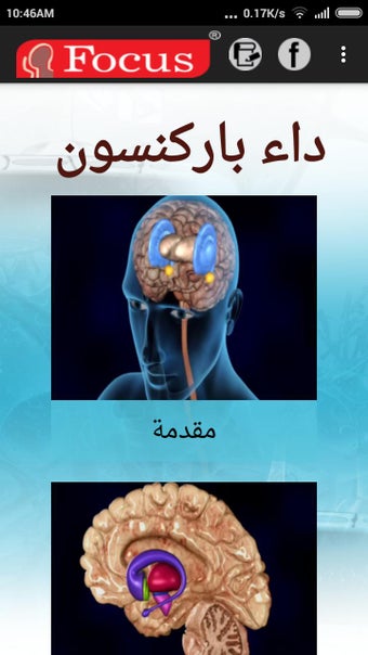 Image 1 for Parkinsons Disease