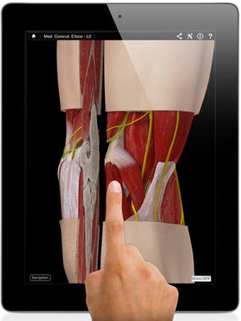 Image 0 for Elbow Pro III