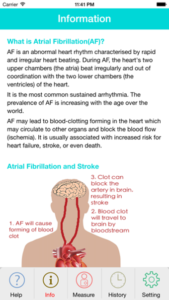 Image 2 for Photo AFib Detector (Free…