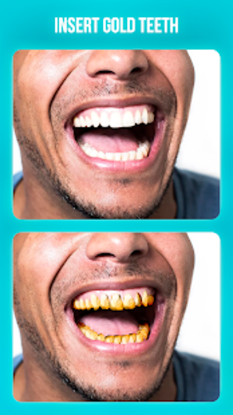 Imagen 1 para Dentist Photo Editor