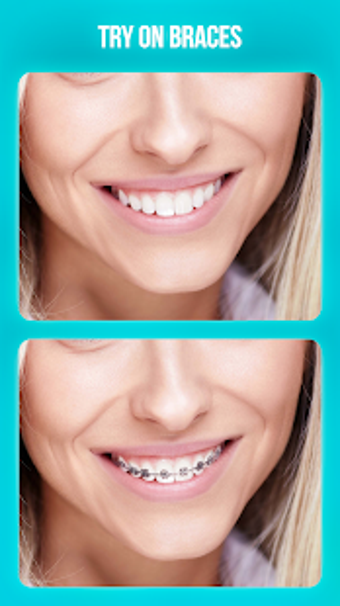 Imagen 2 para Dentist Photo Editor