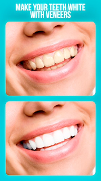 Imagen 0 para Dentist Photo Editor