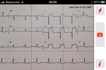 Image 0 for fastECG