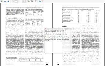Imagen 0 para PDF Stacks