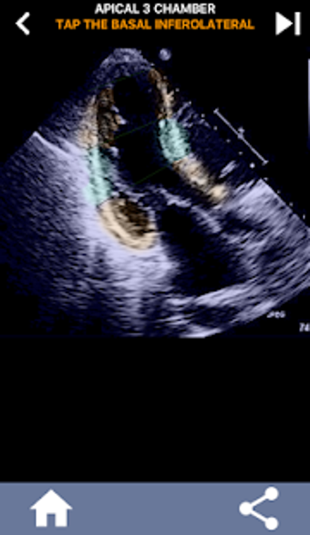 Image 3 for AHA 17 SEGMENT INTERACTIV…