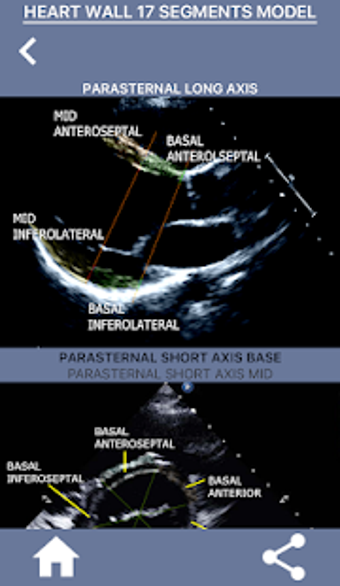 Image 2 for AHA 17 SEGMENT INTERACTIV…