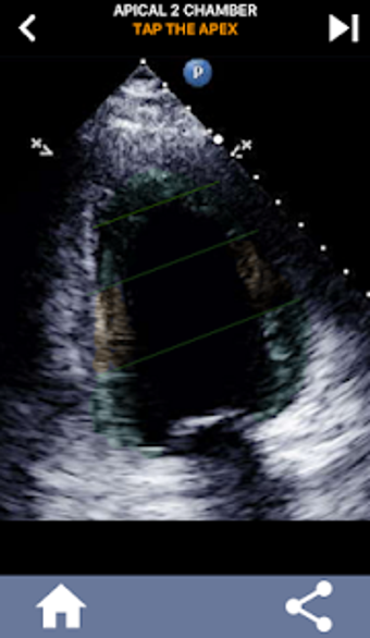 Image 1 for AHA 17 SEGMENT INTERACTIV…