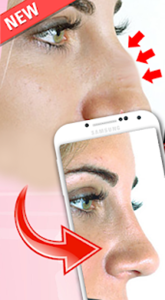 Imagen 0 para Nose Plastic Surgery