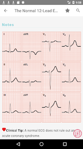 Imagen 3 para ECG Notes : Interpretatio…