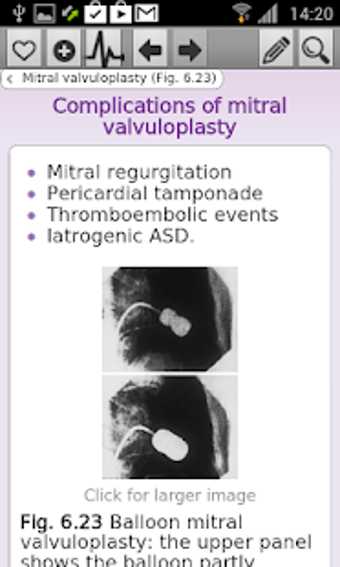 Image 2 for Oxford Handbook Cardiolog…