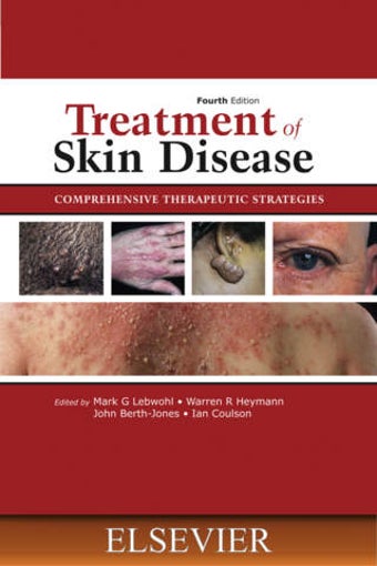 Image 0 for Treatment of Skin Disease…