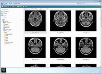 Imagen 0 para MicroDicom shell extensio…